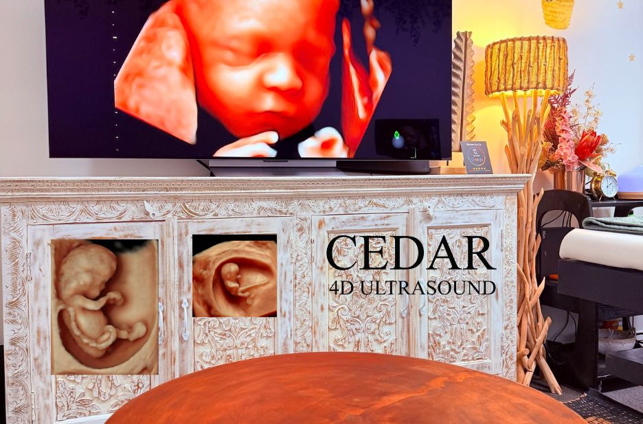 A Heartfelt Preview: 3D Baby Scans for Expecting Perth Families A Heartfelt Preview: 3D Baby Scans for Expecting Perth Families