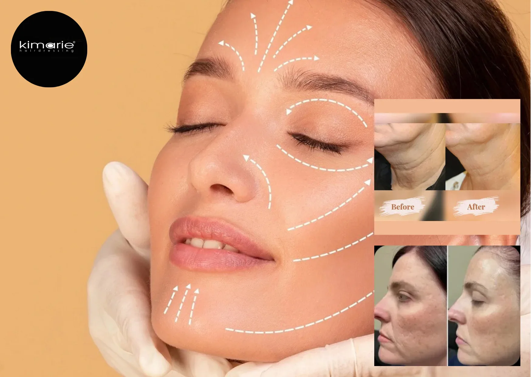 Vitamin C Facial Brampton – Brighten and Revitalize Your Skin Today Vitamin C Facial Brampton – Brighten and Revitalize Your Skin Today